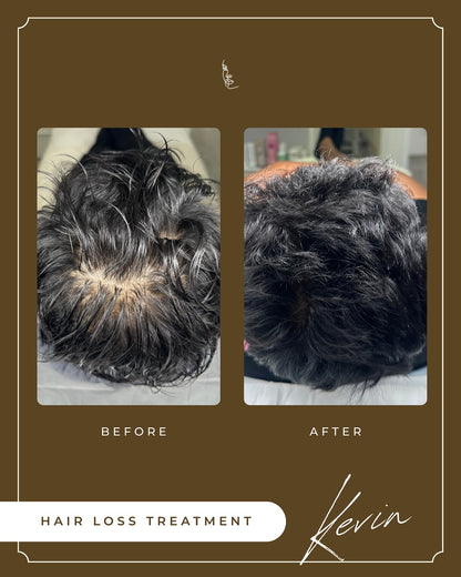 Black Friday Exclusive – Hair Growth & Scalp Regeneration Series (3 Sessions)