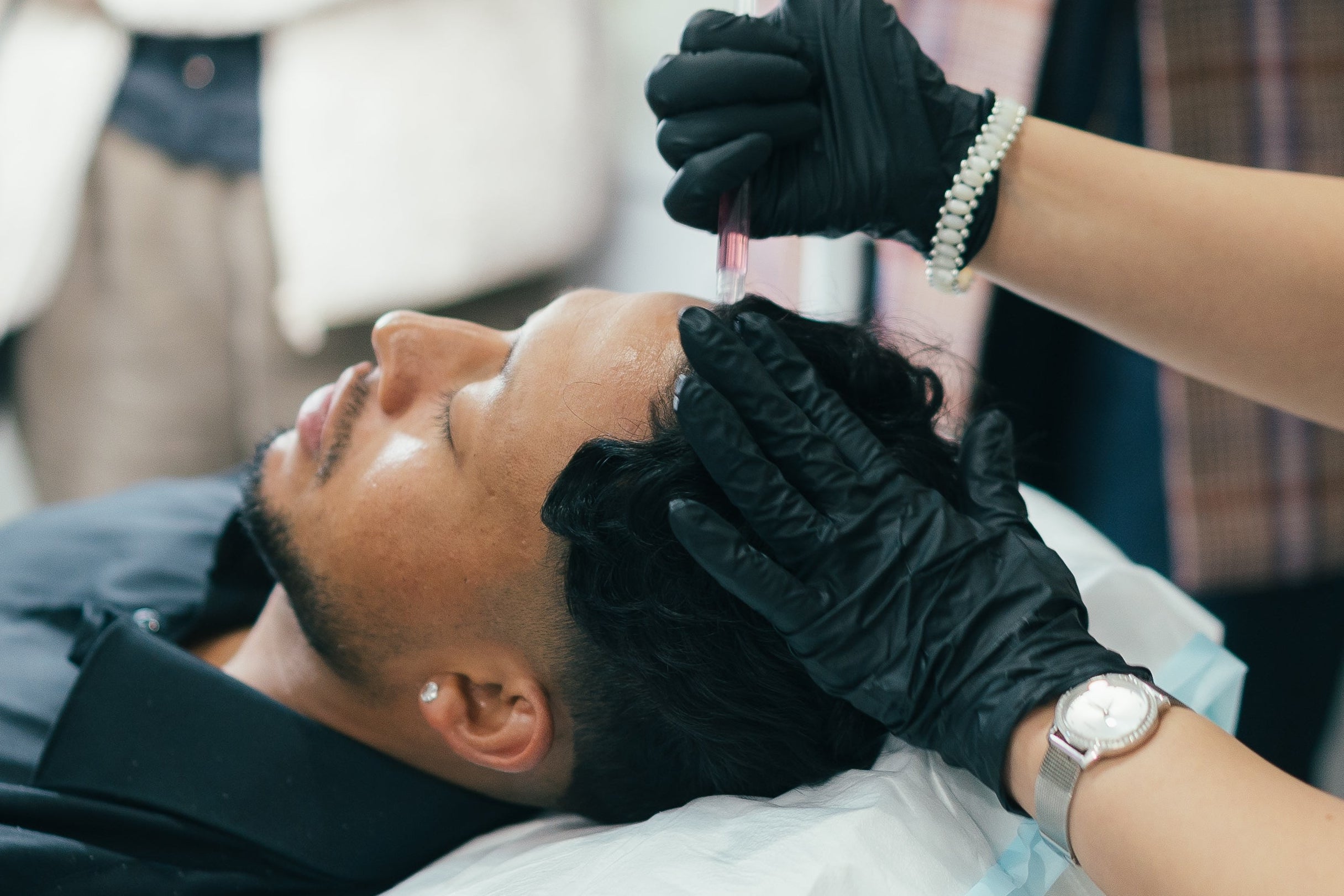Person receiving a hair loss treatment with gloved hands in a blurred indoor setting