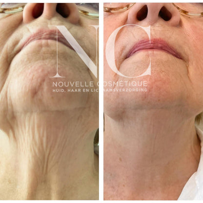 The Neck Lift Intensive Firming Cream