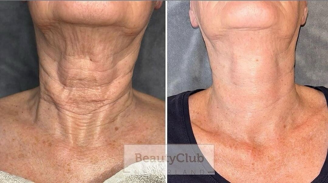 The Neck Lift Intensive Firming Cream