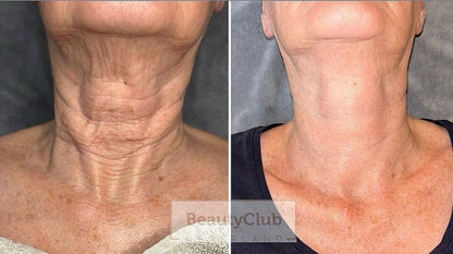 The Neck Lift Intensive Firming Cream