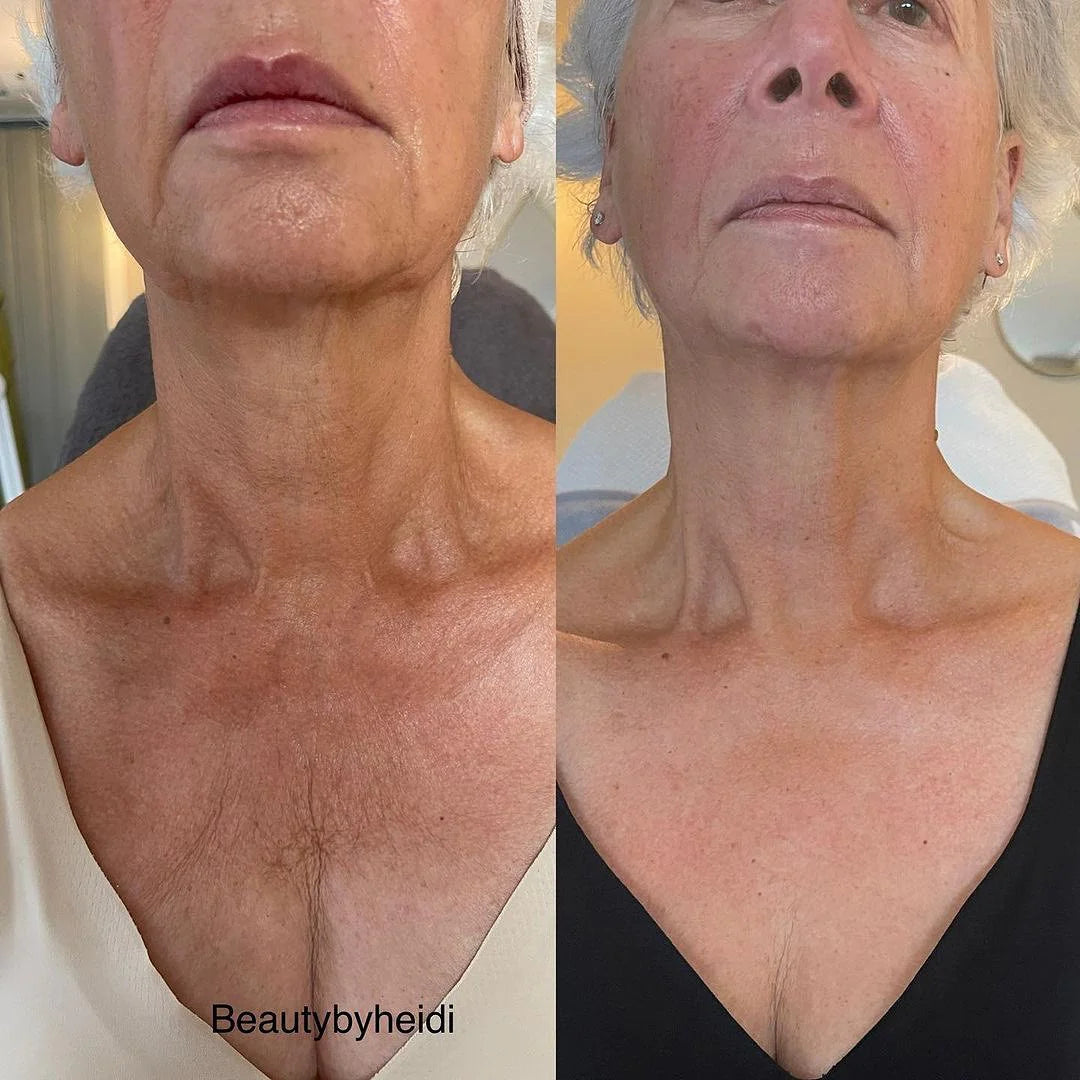 The Neck Lift Intensive Firming Cream